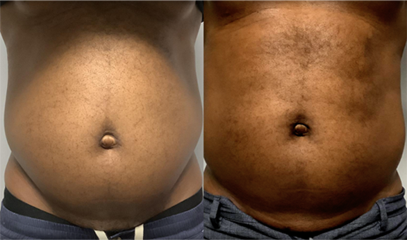 Rogue Mens Wellness Lounge - Before After 1